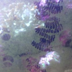 was ist das thumbnail