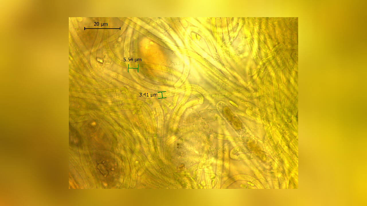 Cyanophyceae Cyanobakterien