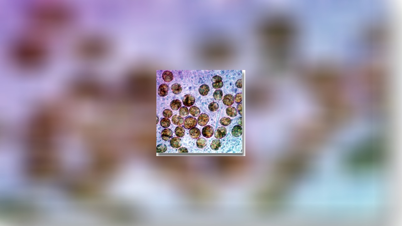 Symbiodinium microadriaticum Symbiodinium microadriaticum