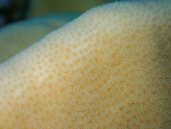 Pavona duerdeni thumbnail